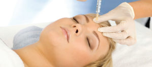 migraines-blog