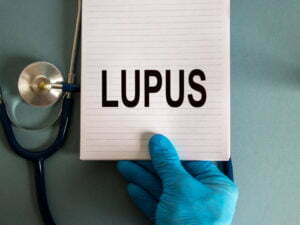 What Is Lupus? Understanding The Condition To Better Treat It