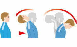 What Is Whiplash And What Can I Do To Relieve My Pain?