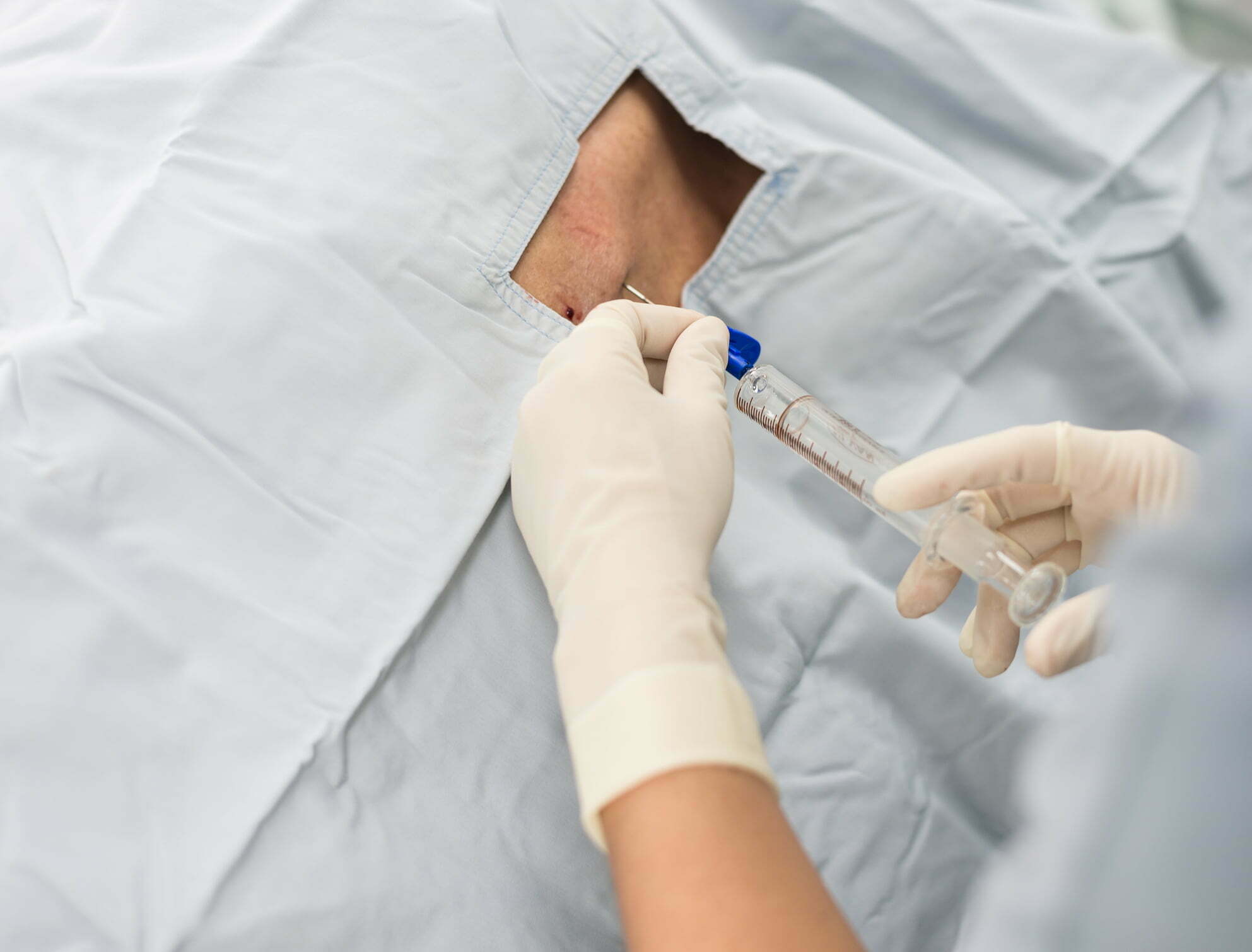 how-to-get-the-best-results-from-epidural-injections-illinois-pain