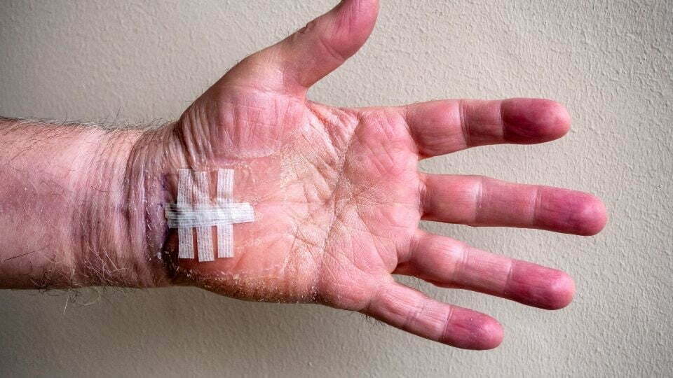 Recovering from Carpal Tunnel Surgery: A Beginners Guide