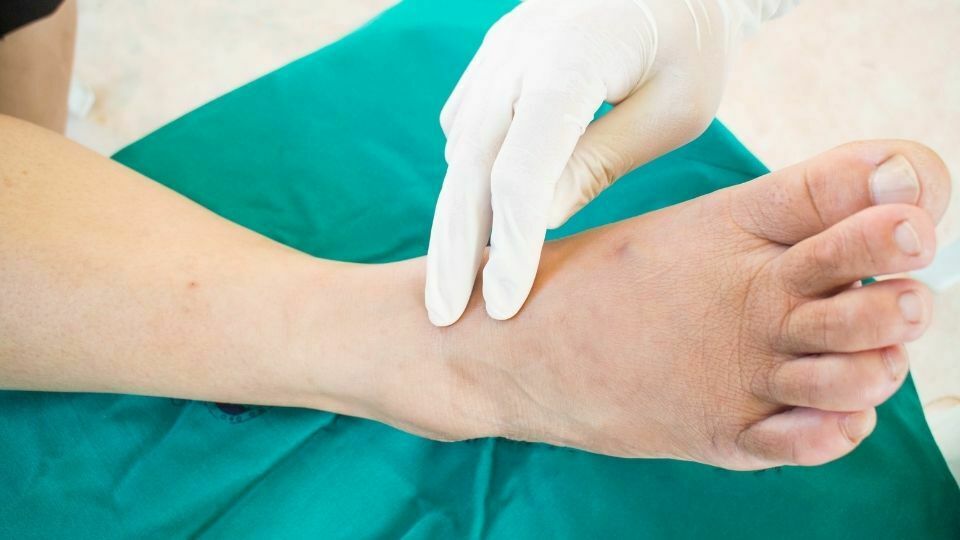 Neuropathy Treatment in Chicago