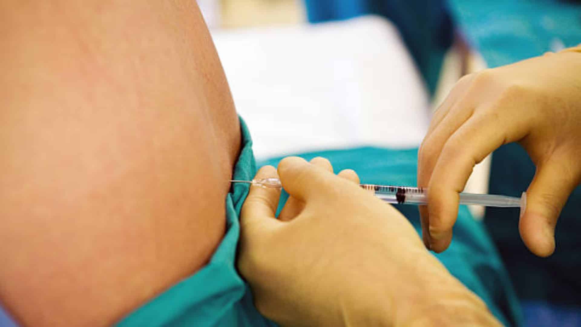 Epidural Injections vs. Facet Injections: Understanding the Difference